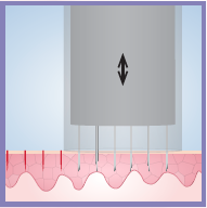 CosmoPen How it Works